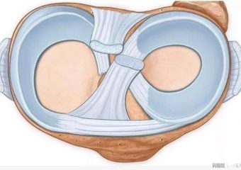 半月板磨损早期症状是什么？为了自己的健康，一定要注意！