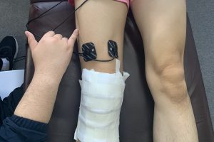 大连运动康复 | 前交叉韧带+半月板也能恢复这么快吗？