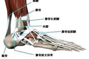 大连运动康复 | 腓骨肌腱滑脱术后案例分享