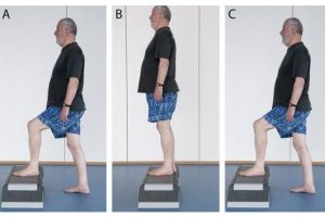 前交叉韧带重建后康复，是不少人犯难的地方