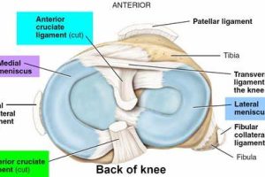 半月板损伤可以自行修复吗?
