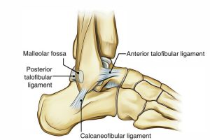 轻中度脚踝扭伤 休息后应尽早康复训练
