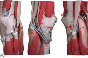 半月板损伤：原因、风险动作与症状全解析