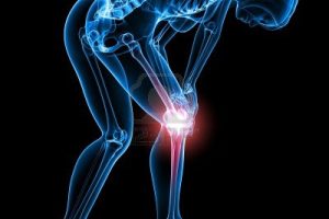 大连运动康复|职业运动员撕脱性骨折康复分享