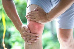 运动损伤的早期处理与恢复