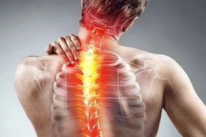 大连运动康复|青少年脊柱侧弯，早发现早纠正！