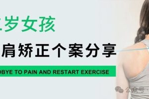 大连运动康复|12岁女孩高低肩矫正个案分享