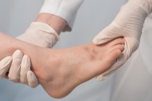 踝损伤的机制以及损伤管理