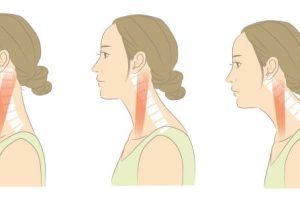 手机玩多了肩颈酸痛难忍？5个科学康复动作拯救你的”手机颈”，告别僵硬找回灵活！