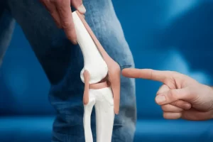 膝关节前叉术后康复：运动康复的全程指南